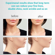 Load image into Gallery viewer, RejuveLift™ - Skin Rejuvenating Device
